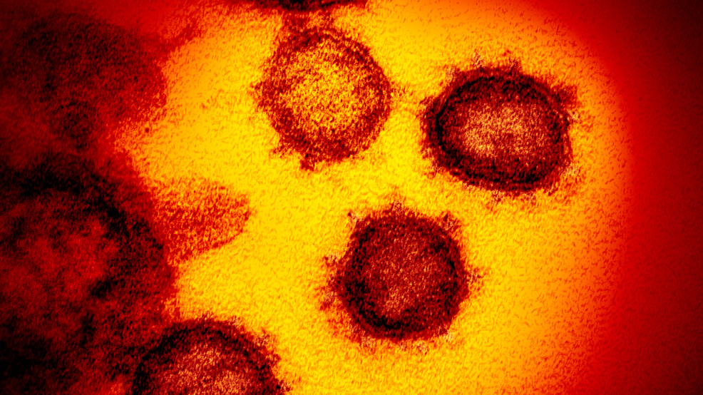 Virus Outbreak-New Testing Option AP20132728571996.jpg