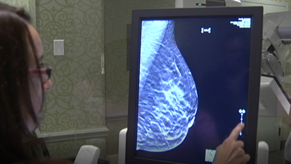 Mother’s Day Reminder: Make sure women in your life get a mammogram, health officials say